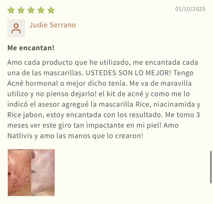Rutina para Acné
